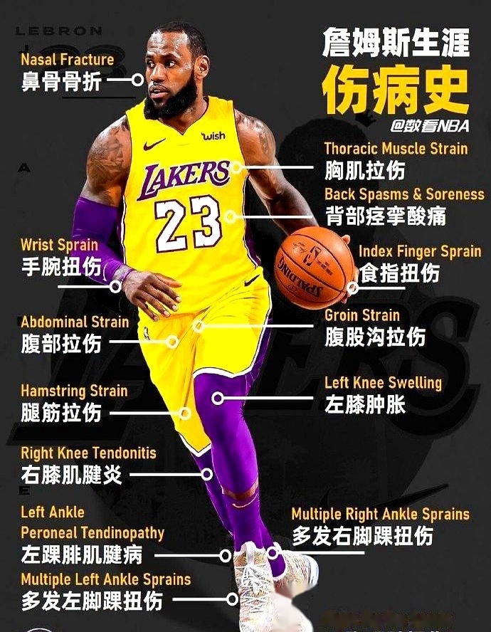 米兰体育链接-包含詹姆斯再度缺战,湖人铁血核心缺阵对球队影响深远的词条